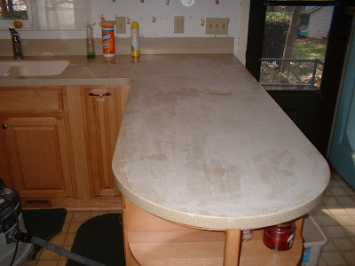 Acetone Burn