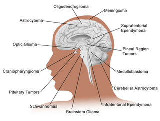 [brain.png]