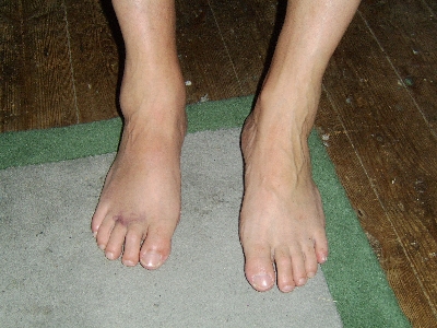 [Feet.JPG]