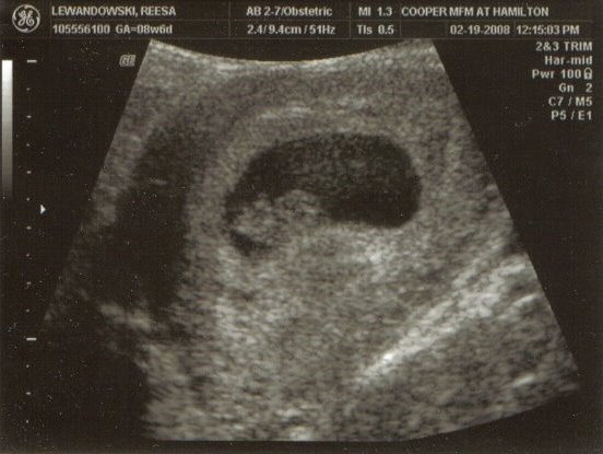 Baby Lew - 8 weeks