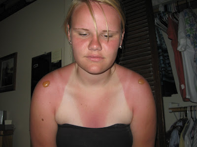 No Sunscreen