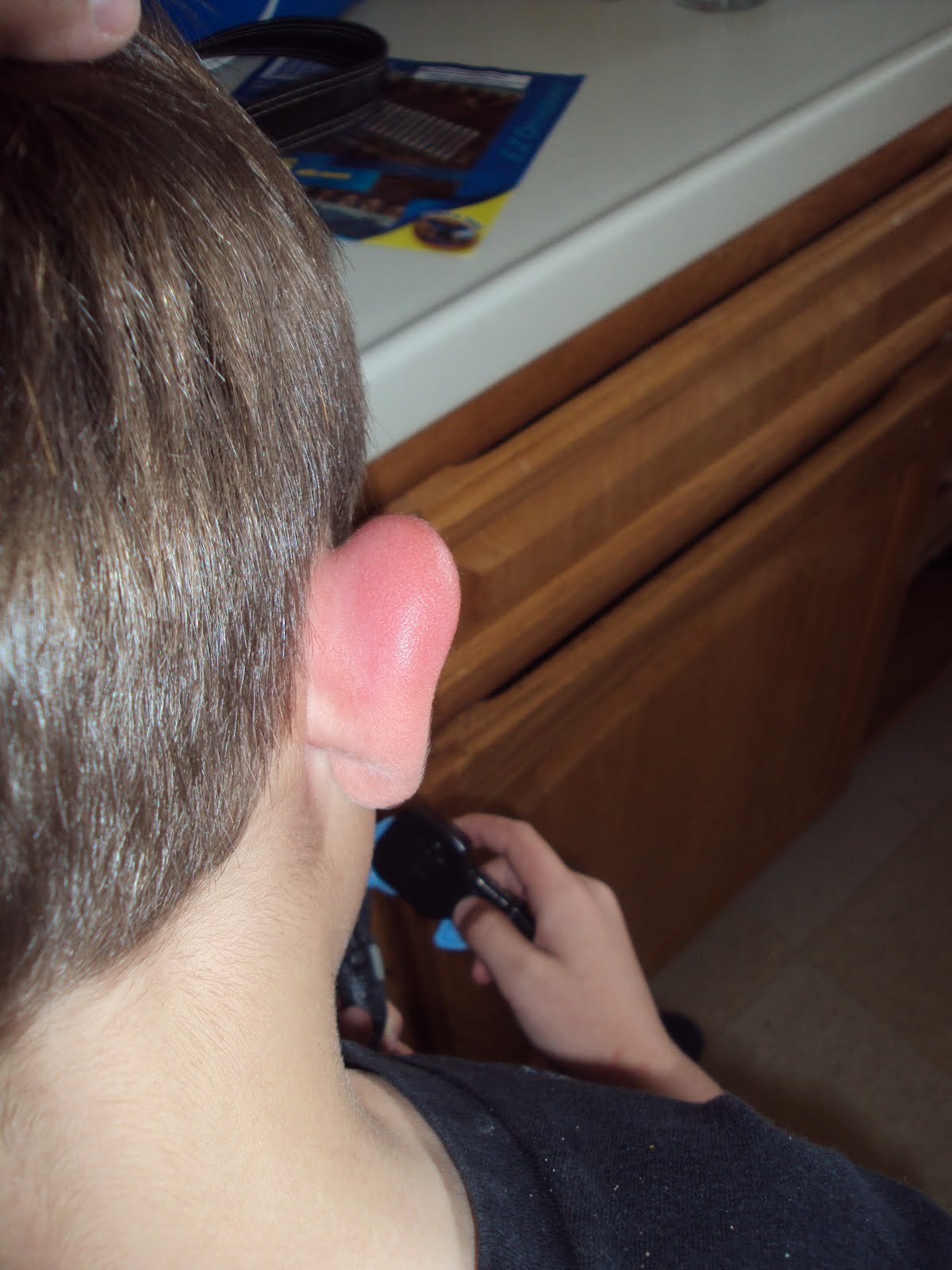 Swollen Ears