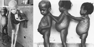 7 Foto Penderitaan Paling Sedih Sepanjang Masa 7 Foto Penderitaan Paling Sedih Sepanjang Masa.alamindah121.blogspot.com