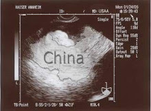 China ultrasound