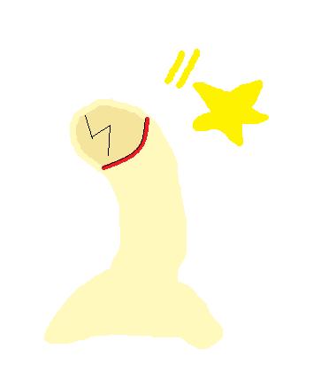 [dedo.jpg]