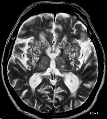 mri notes 8, mri physics iii (pdf - 21 mb), wald part 4 imaging physiology 9, imaging physiology i: brain at the baseline (pdf - 17 mb), bolar 10, imaging physiology ii:. mri notes 8, mri physics iii (pdf - 21 mb), wald part 4 imaging physiology 9, imaging physiology i: brain at the baseline (pdf - 17 mb), bolar 10, imaging physiology ii:.