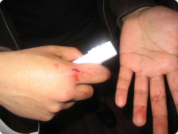 [wiiinjury.jpg]