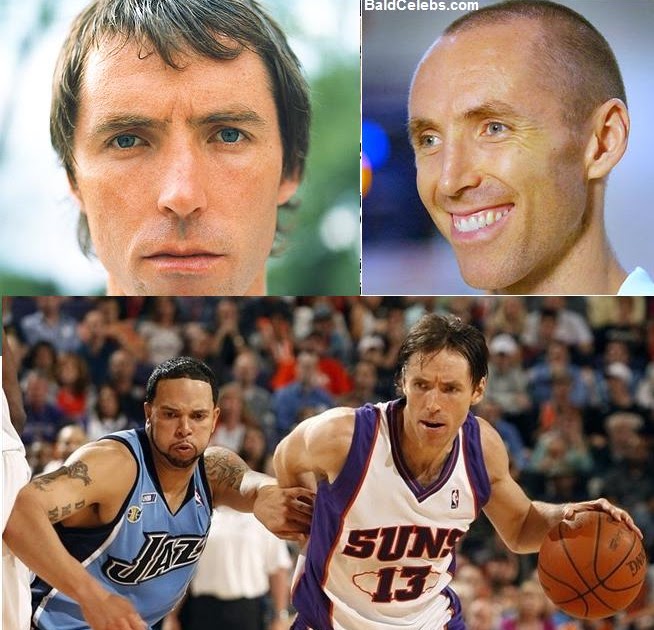 Baldcelebs Com Steve Nash Nba
