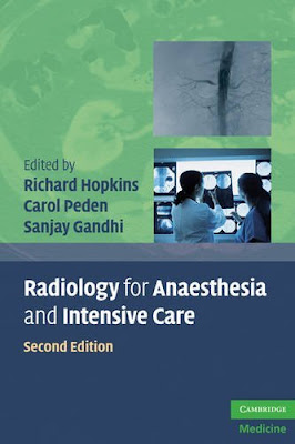 Radiology for Anaesthesia and Intensive Care (Cambridge Medicine) Radiology+for+anesthesia