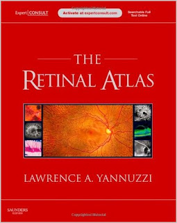 The Retinal Atlas: Expert Consult - June 2010 Edition Retina+atlas
