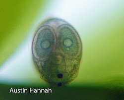 Lateral View of Seed Shrimp
