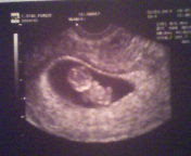 1° eco de mi bebe