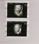 Colston at 26 Weeks 4D