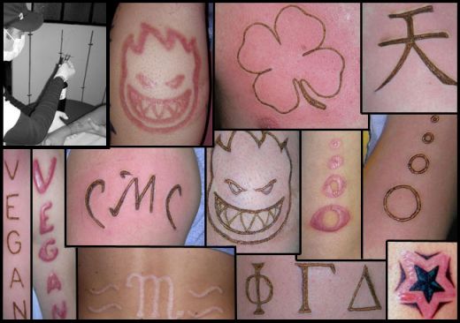 scarificationtattoos 10 Insane Scarification Tattoos image gallery