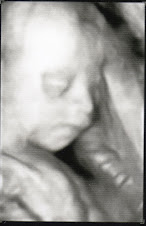 In utero