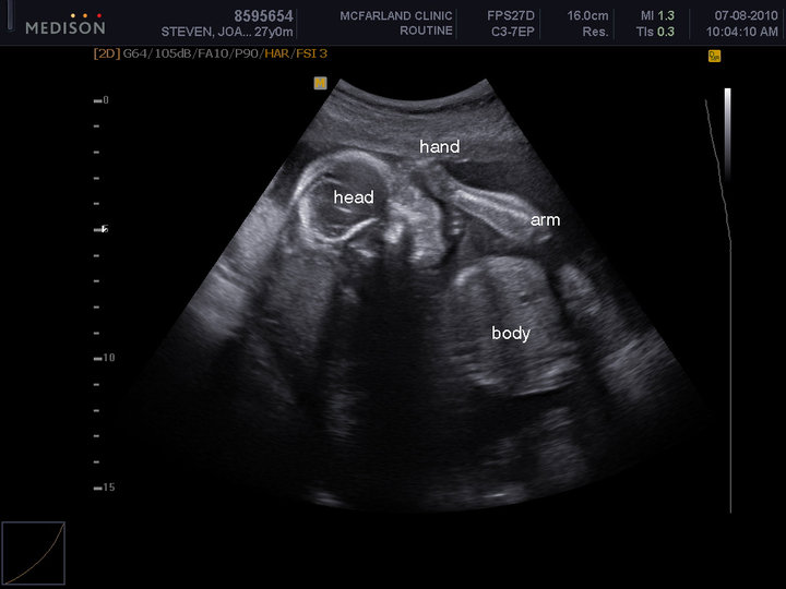 shake rattle baby clothes