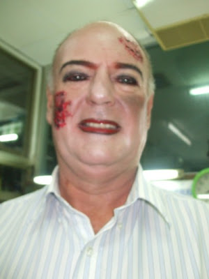 road rash face