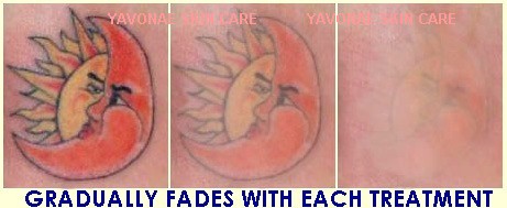 [TATTOO+-+YAVONAE.JPG]