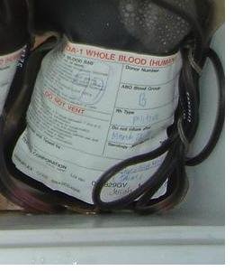 [BLOOD+BAG+FOR+RANDOM+THOUGHTS+FINAL.JPG]