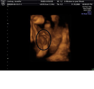 22+weeks+pregnant+scan