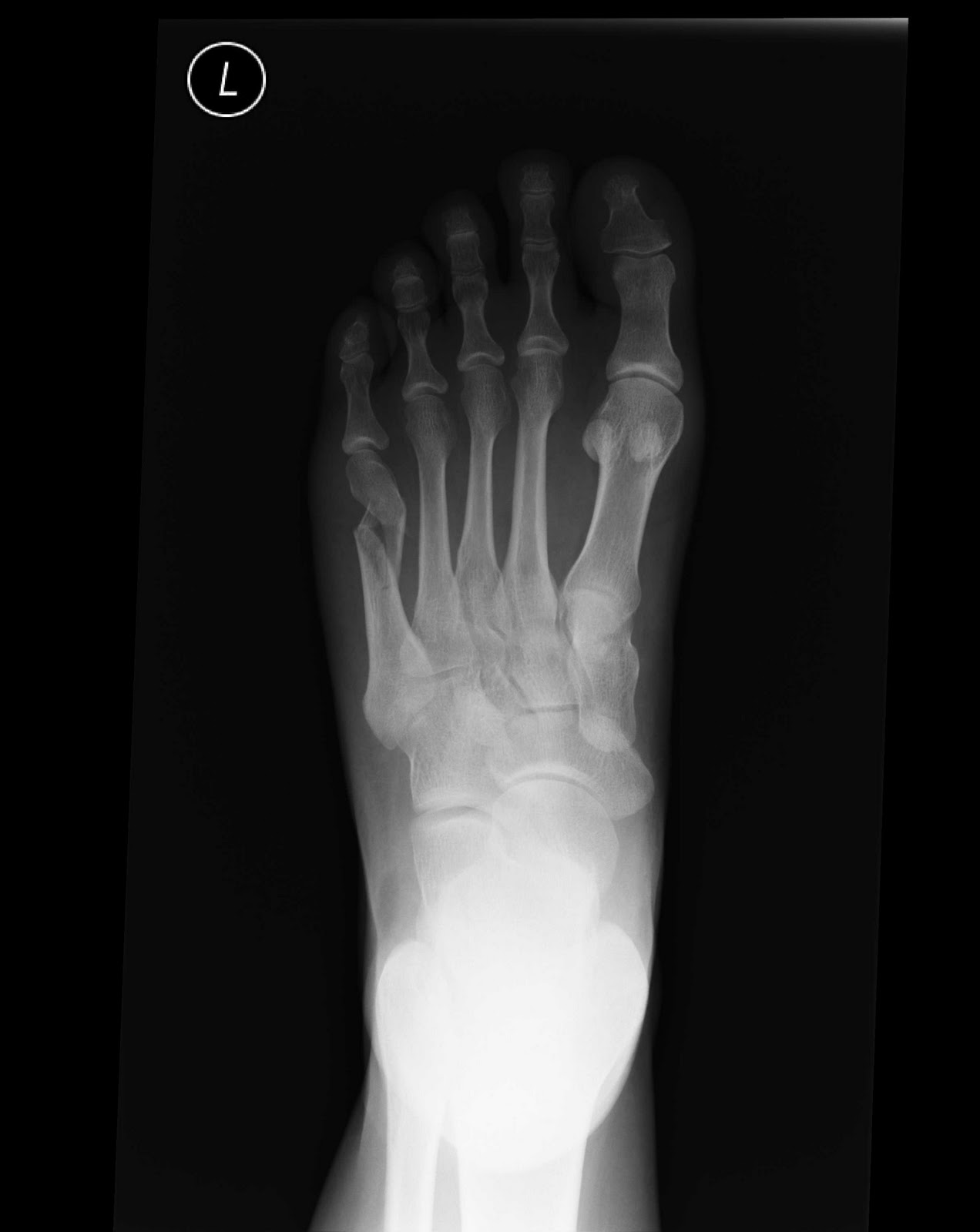 ap foot