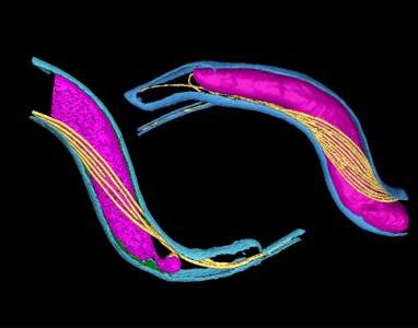 Lyme borreliosis