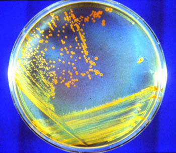 inoculated 2 petri plates inoculated 2 petri plates