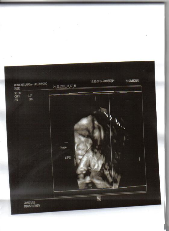 [babyscan+3d2+(Large).jpg]