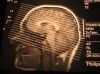 [_x-ray_head.jpg]