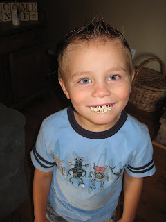 rotten teeth pilgrim smells tooth sam days extraction dentist