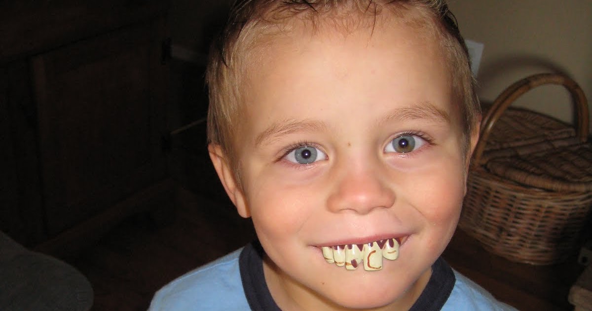 These Pilgrim Days Rotten Teeth & Rotten Smells