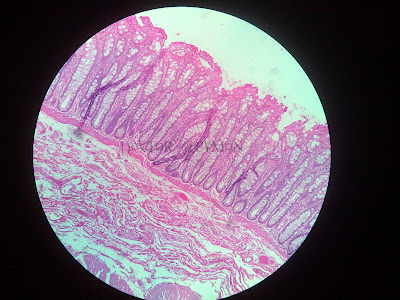 Colon Histo