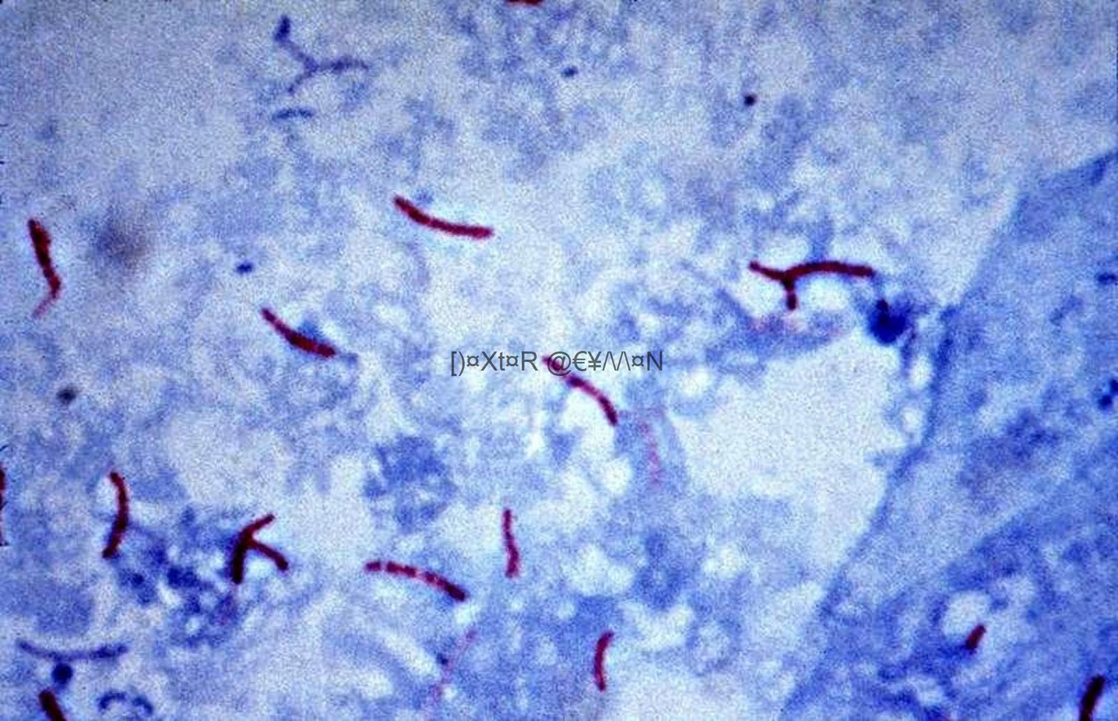 Gram Positive Slide