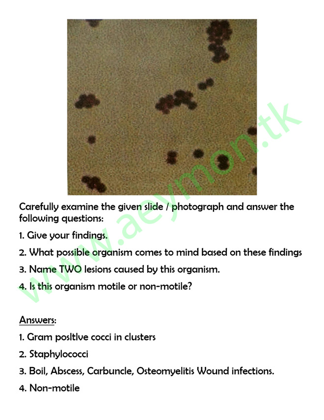 3rd Year MBBS BACTERIOLOGY (pathology) OSPE by UHS Medical ebooks and