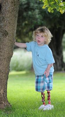 [engelsizdunyamprotezcocuk3.jpg]