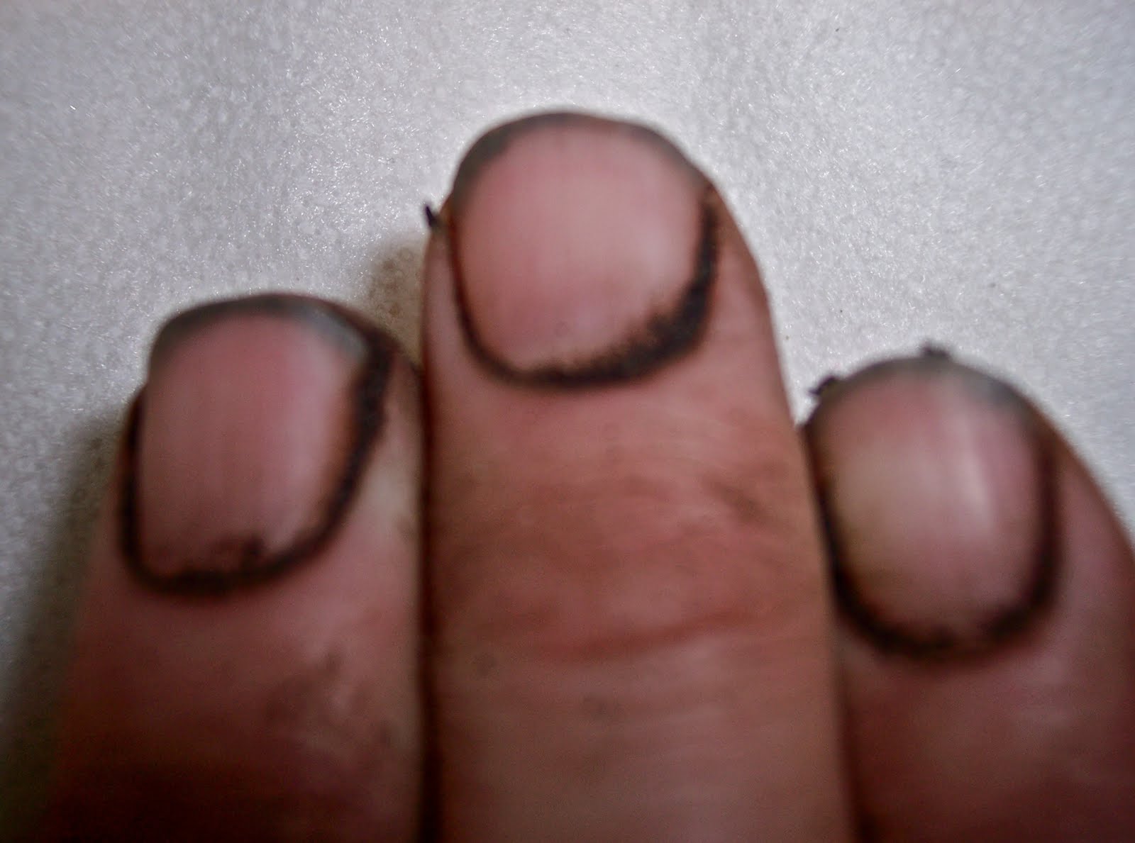 Dirt Under Fingernails