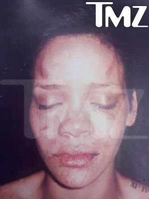 rihanna beaten pictures. Rihanna Bruised And Battered!