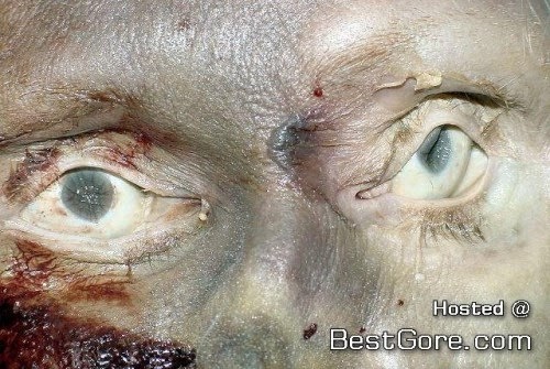 Gore pictures of accidents, deaths and murders.: Freaky Looking Post