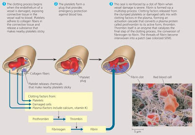 atheromatous unfolding