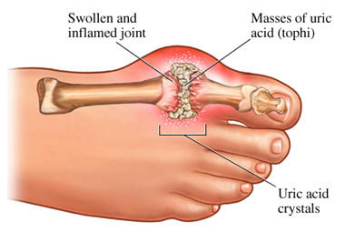 awful pain in your foot,