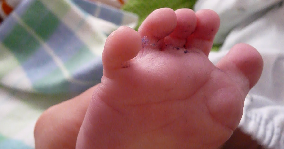 Katie & Tyler Toe Jam