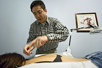 Dr. Mark Xu inserts acupuncture needles into a patient at his clinic. Chinese medicine looks at you as a whole person, and Western medicine looks at the exact individual problem, said Xu, who is a third-generation acupuncturist.