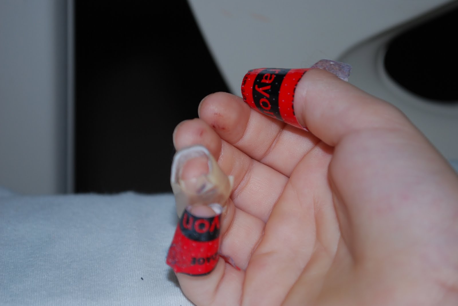 diabetic fingers