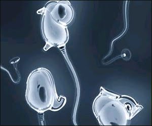 [M_Id_48782_Sperms.jpg]