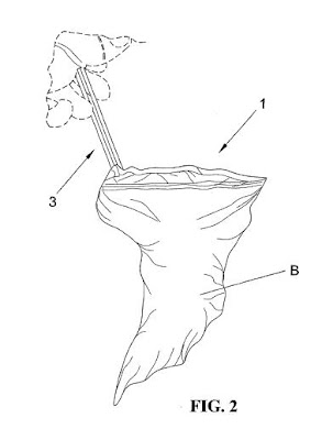 Invento nuevo: Recogida de excrementos