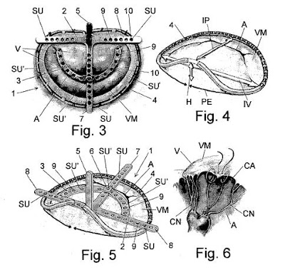 Invento: Reparación válvula mitral
