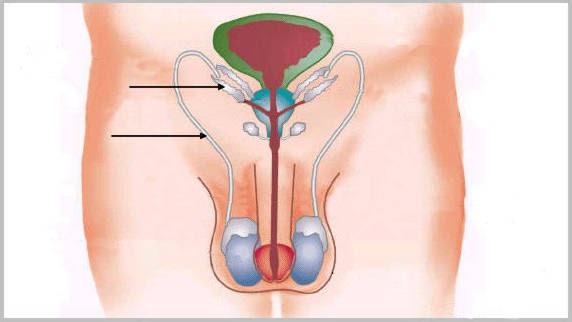 Hermafroditismo Porque Sucede El Hermafroditismo