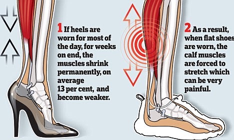 Shoe Shop Talk: The Cut Asks: Heels or Flats? diagram of blisters 