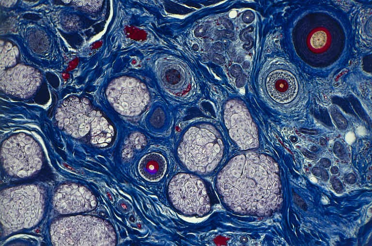 picture image per 24 hour period Human skin under a microscope