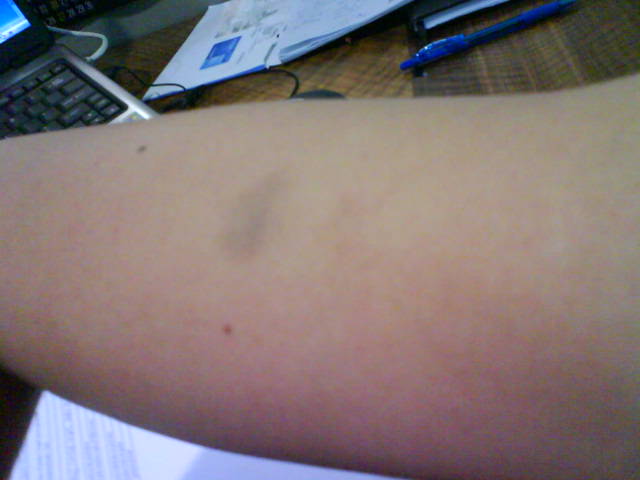 two plus two love bite two plus two blogger